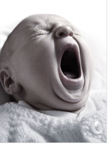 Syndrome du bébé secoué: symptômes et conséquences